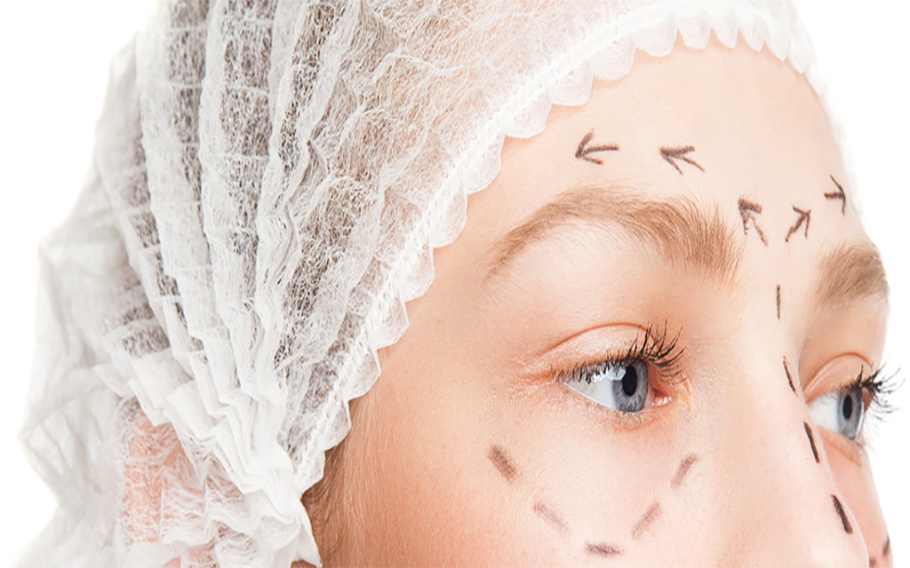 TRATTAMENTO CON FILLERS E BOTULINO